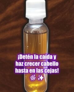 Tratamiento natural casero para caída del cabello con ingredientes naturales como aceite de ricino, cebolla y aloe vera dispuestos sobre mesa de madera